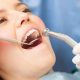 chirurgie esthétique dentaire