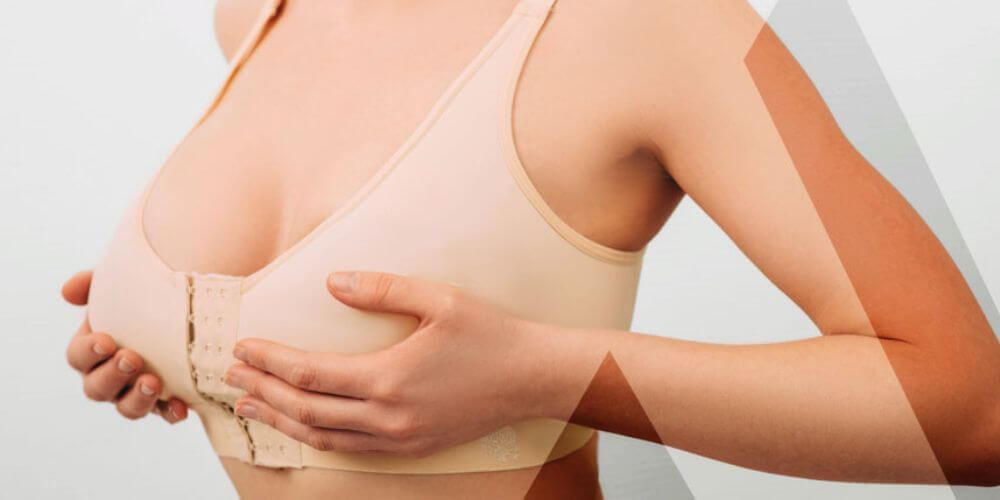Une femme portant un soutien-gorge de compression après une chirurgie mammaire, qui aide à la guérison et à la récupération des seins.