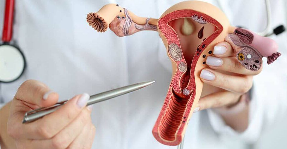 chirurgie vaginale sur mesure